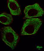 beta Tubulin Monoclonal Antibody (87CT59.3.7)