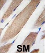 CLIC4 Monoclonal Antibody (17CT9.2.8)