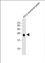 ATG12 Monoclonal Antibody (43CT73.3.5.5.4)
