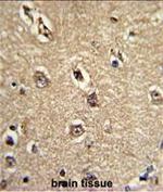 Beclin 1 Monoclonal Antibody (117CT2.5.1.1)