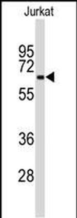 Beclin 1 Antibody in Western Blot (WB)