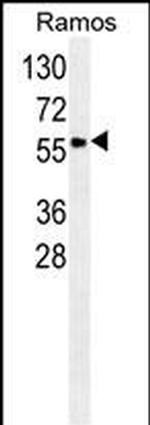 SERPINA9 Monoclonal Antibody (136CT29.7.4)