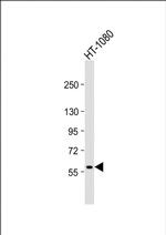 MMP14 Antibody in Western Blot (WB)