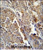 ALDH3A2 Monoclonal Antibody (151CT1.3.1)