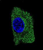 LAMP2 Antibody in Immunocytochemistry (ICC/IF)