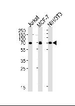 RPS6KB2 Monoclonal Antibody (164CT21.2.2)