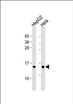 THEM2 Monoclonal Antibody (169CT7.1.3)