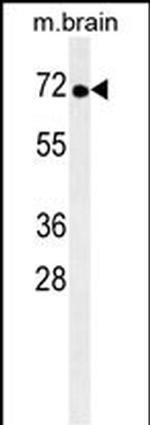 TNK1 Monoclonal Antibody (170CT7.5.4)