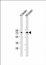 LIMK1 Monoclonal Antibody (175CT3.2.5)
