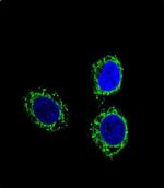 Nephrin Antibody in Immunocytochemistry (ICC/IF)