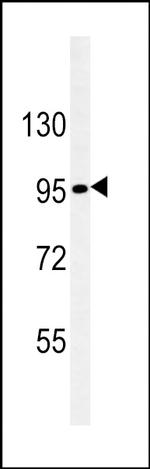 Nephrin Antibody in Western Blot (WB)