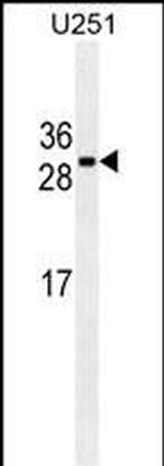 CDCA8 Monoclonal Antibody (181CT41.2.3)