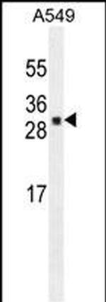 UBTD1 Monoclonal Antibody (189CT14.5.4)