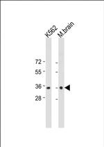 CAB39 Monoclonal Antibody (198CT13.9.1)