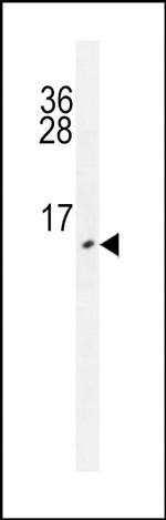 URM1 Monoclonal Antibody (182CT27.2.2)