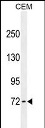 ZFP37 Antibody in Western Blot (WB)