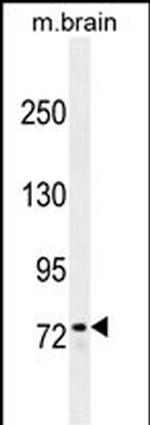 ZFP37 Antibody in Western Blot (WB)