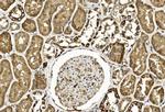 TGF beta-2 Antibody in Immunohistochemistry (Paraffin) (IHC (P))