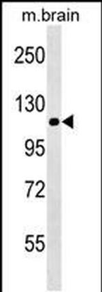 NALP12 Monoclonal Antibody (228CT4.1.3)