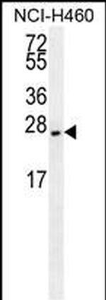 eIF4E2 Monoclonal Antibody (225CT3.1.3)