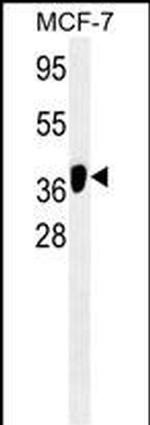 ATG4B Monoclonal Antibody (231CT21.1.7)