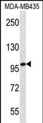 MYO1C Monoclonal Antibody (221CT4.7.2.4)