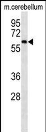 CAMKK2 Monoclonal Antibody (239CT7.5.3)