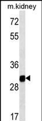 GNPDA1 Monoclonal Antibody (237CT2.5.2)