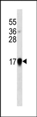 IFN alpha Monoclonal Antibody (278CT1)