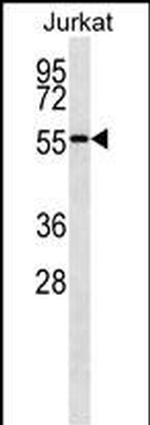 NUP50 Monoclonal Antibody (247CT10.2.5)