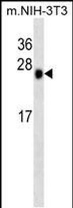 CK2 beta Monoclonal Antibody (260CT10.1.1)