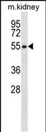 RPS6KL1 Monoclonal Antibody (273CT4.5.3)