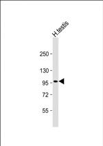 HIPK4 Monoclonal Antibody (292CT1.4.1)