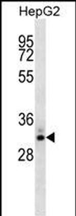 STC2 Monoclonal Antibody (339CT13.2.6)