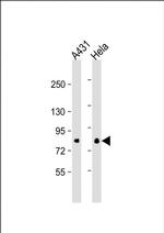 eIF4B Monoclonal Antibody (355CT12.6.5)
