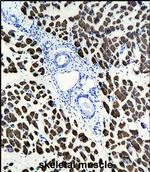 ACTA1 Monoclonal Antibody (337CT30.10.1)