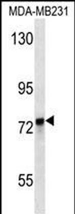KEAP1 Monoclonal Antibody (297CT6.1.6)