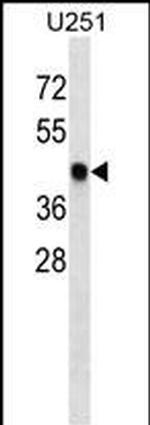 SNX6 Monoclonal Antibody (335CT6.4.6)