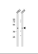 PDK4 Monoclonal Antibody (345CT19.6.2)