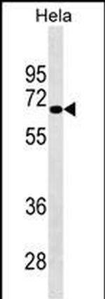 NUAK2 Antibody in Western Blot (WB)