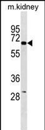 Kir3.1 (KCNJ3) Antibody in Western Blot (WB)