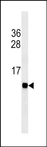 FABP3 Monoclonal Antibody (388CT12.2.4.1)