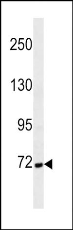 Cortactin Antibody in Western Blot (WB)
