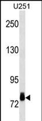RSK2 Monoclonal Antibody (356CT10.6.1.2)