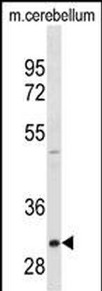 ZWINT Monoclonal Antibody (422CT4.6.4)