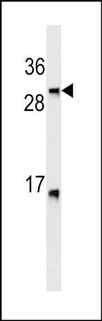 LTB Monoclonal Antibody (399CT9.3.4)