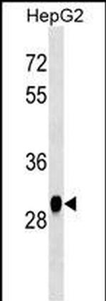 HNMT Monoclonal Antibody (432CT31.4.2)