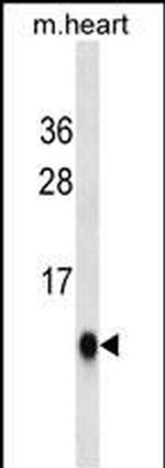 UBL5 Monoclonal Antibody (429CT16.3.1)