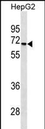 STK39 Monoclonal Antibody (430CT4.4.1)