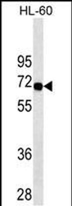 SWAP70 Monoclonal Antibody (434CT16.5.5)